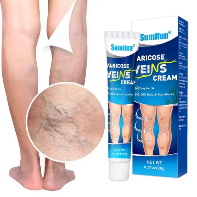 20g Treatment Legs Varicose Veins Cream Vein Care Fading Cream Ointment U9Q7