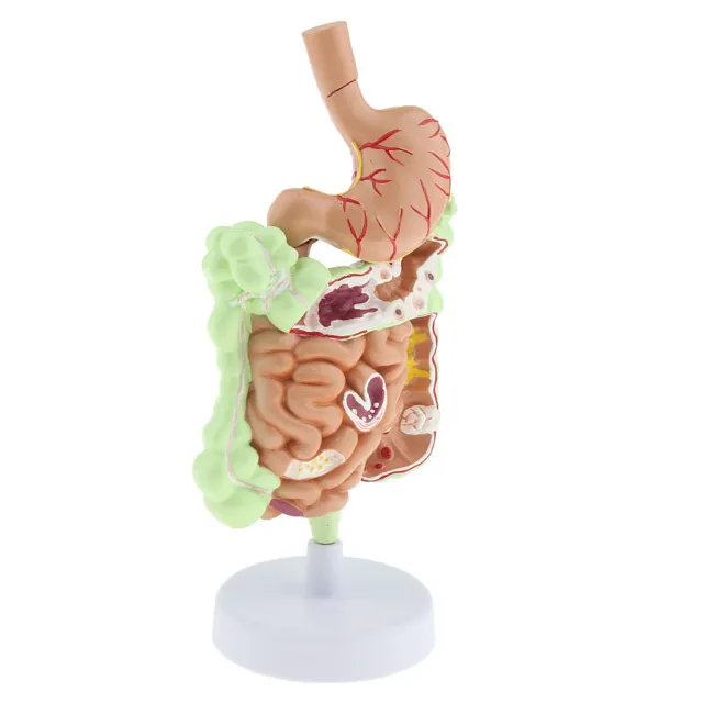 Anatomy of Human Digestive System Stomach Gastrointestinal Model