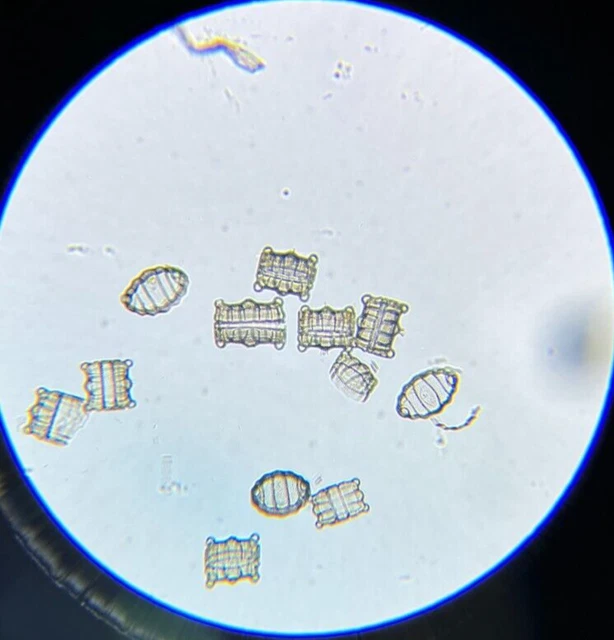 Antique A.C. Cole Prize Medal 1867 Microscope Slide Diatom Biddulphia Pulchella