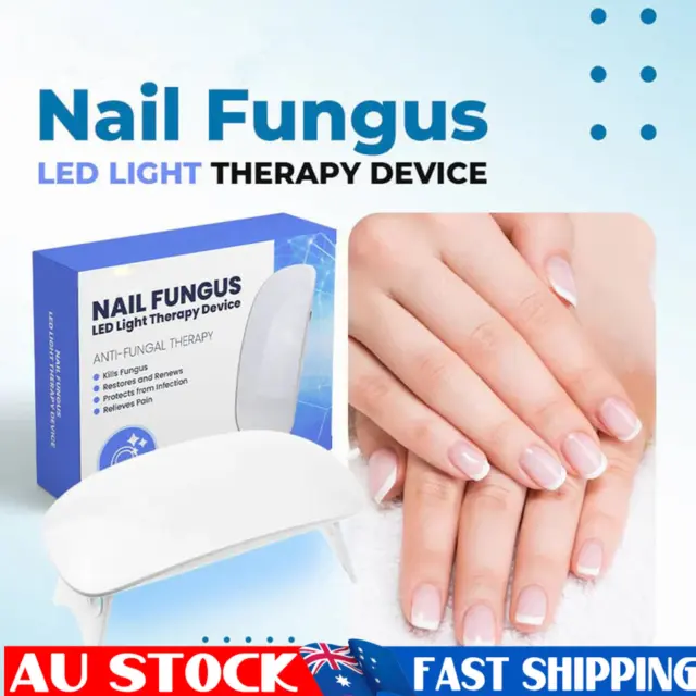 how to cure nail fungus at home/cure nail fungus at home/home cure for toenail  fungus - YouTube