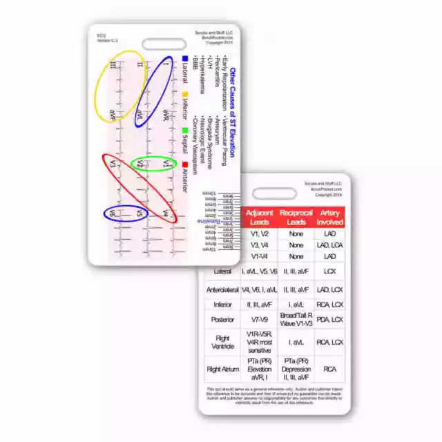 12 Lead STEMI Tool w/ Corresponding Vessels Chart Vert Badge Card Nurse EMT RN