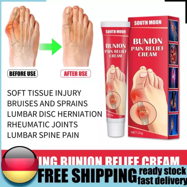 20g Arching Bunion Relief Cream Joint Toe Pain Relief Stiffness Treatment