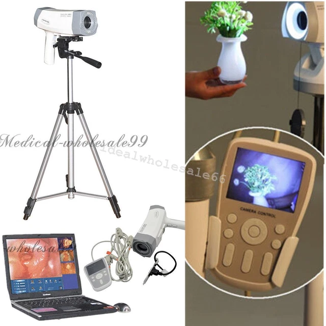 Digital Carema Electronic Colposcope video 800,000 + LED Handle +Tripod