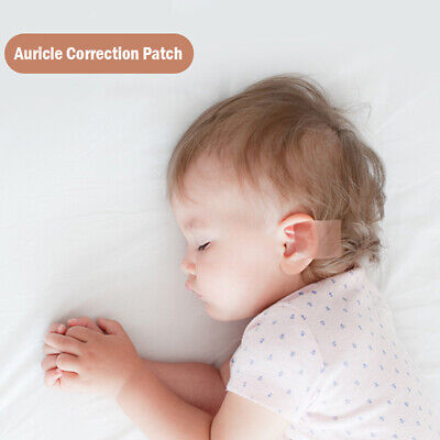 Correctores de oído para bebé cinta médica de silicona corrección de oído infantil Pa~QZ