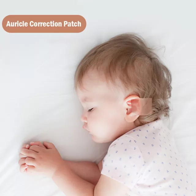 Correttori orecchie bambino nastro medico silicone patch orecchio neonato^