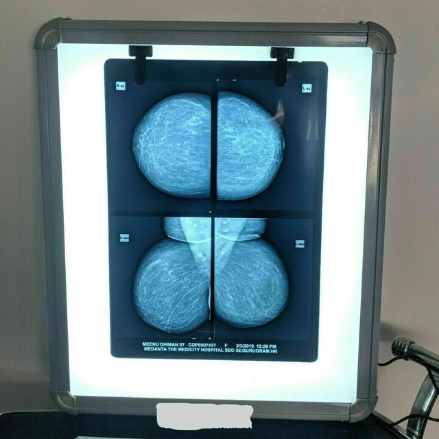 LED X-Ray 17" x 14'' Viewer Illumination With High Brightness