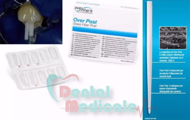 Perni Endocanalari In Fibra Di Vetro Conical Overpost, Offerta Dentista, Dentale