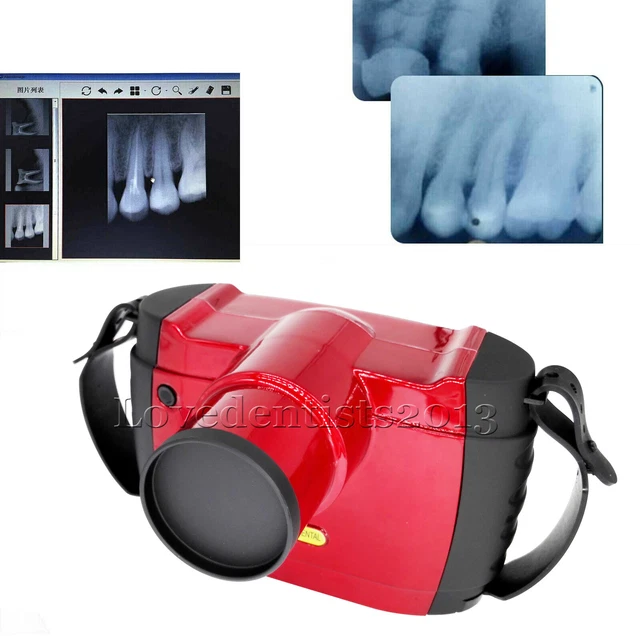 Dental Portable Digital X-Ray High Frequency Intraoral Imaging System BLX10