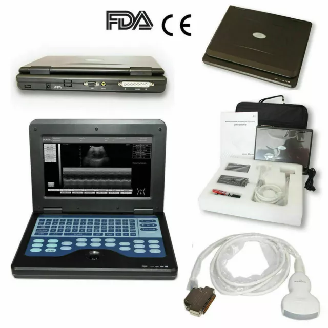 Portable Ultrasound Scanner Laptop Machine 3.5M Convex Probe System,CE CMS600P2
