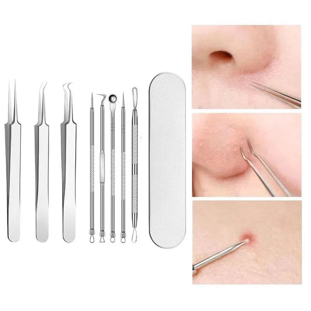 Set rimozione brufoli per pinzetta estrazione acne e punti neri con E0G1