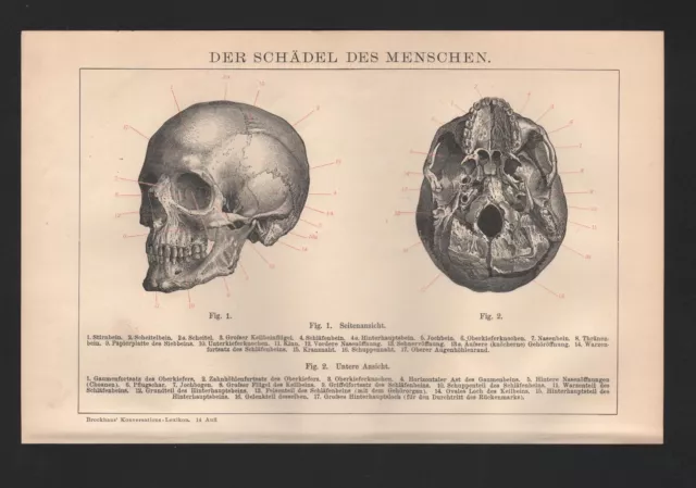 Lithografie 1898: Schädel des Menschen. Stirnbein Gaumenfortsatz