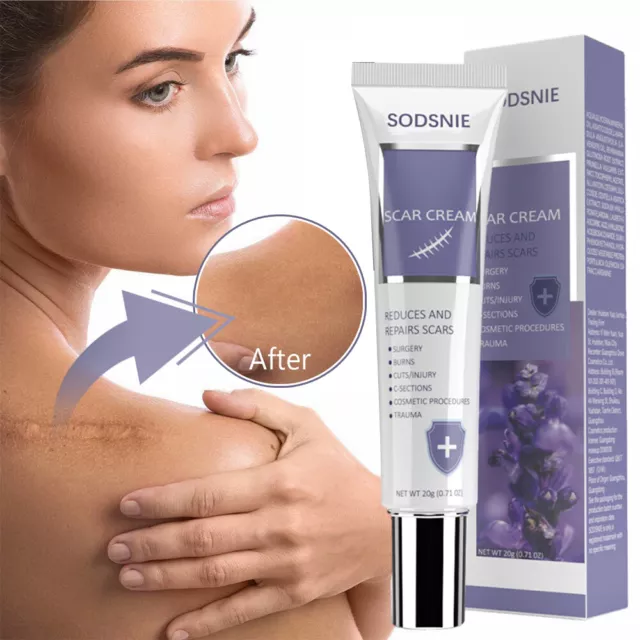 Best Scar removal Cream Skin Care for Scars Reduce Surgery Acne Stretch Marks