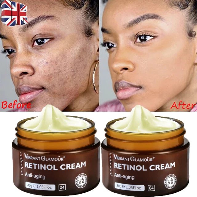Retinol cream uk deals