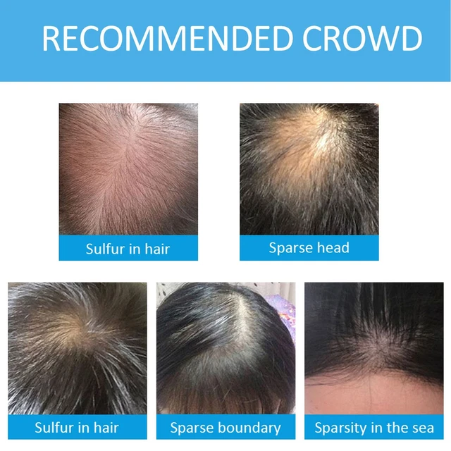 Professional Hair Thickening Fibers Portable Keratin Hair Loss Concealing Fil US