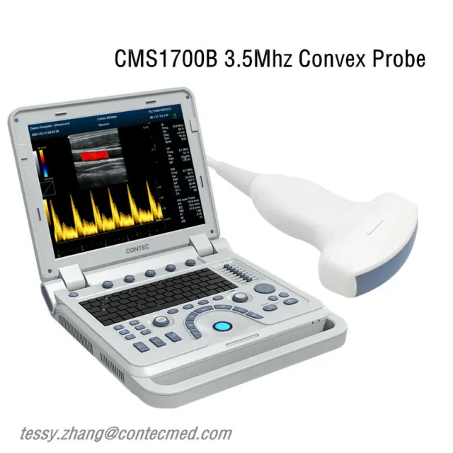 CMS1700B Color Doppler CF Ultrasound Scanner Machine Convex abdominal Probe