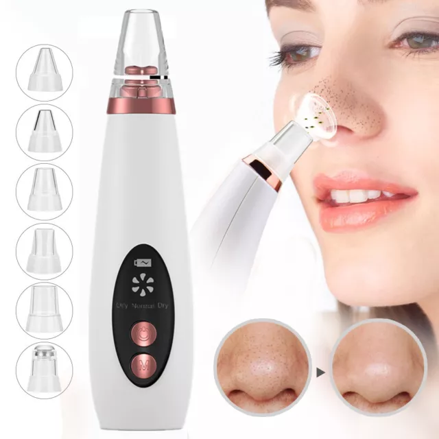 6 in 1 Electric Blackhead Remover Facial Skin Pore Cleaner Vacuum Acne Cleanser