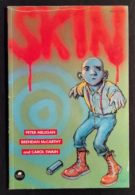 Skin graphic novel 1992 Peter Milligan Brendan McCarthy Tundra Publishing comic