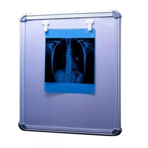 X Ray Lead View Box Viewer Double Ray Sealed Activation Automatic Xray