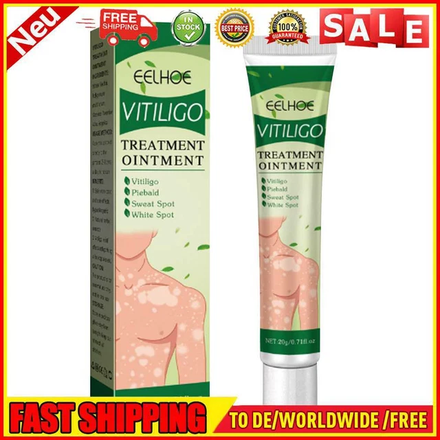 20 g creme per la cura delle macchie cutanee topiche crema trattamento macchie bianche forniture per la cura della pelle