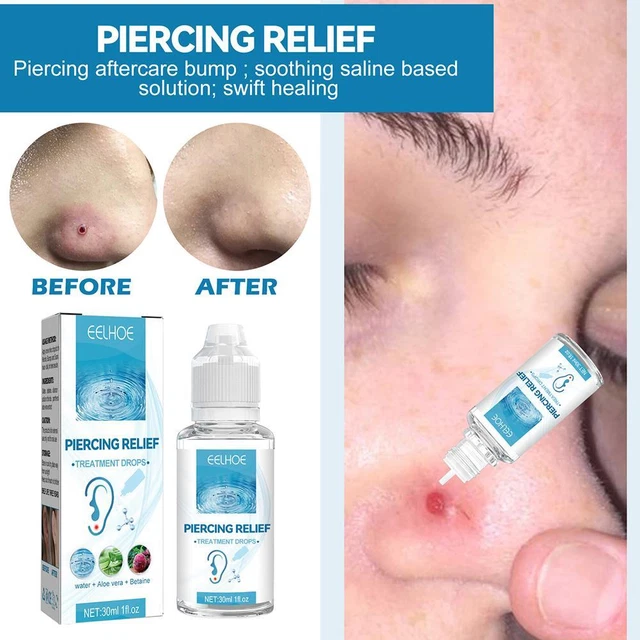 Piercing para el cuidado posterior protuberancia gotas de alivio hidratante calmante;