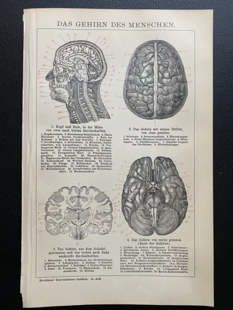 antike Grafik Medizin / Anatomie: Gehirn des Menschen um 1900