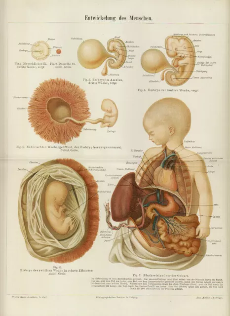 Embryo Fötus Schwangerschaft  Gynäkologie  Medizin  Lithographie 1894