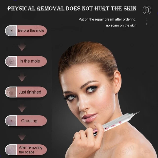 Lápiz láser lápiz láser plasma removedor de etiquetas de piel belleza herramienta de cuidado