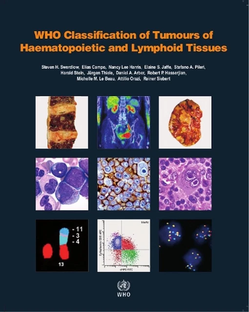 WHO CLASSIFICATION OF tumours of haematopoietic and lymphoid tissues ...