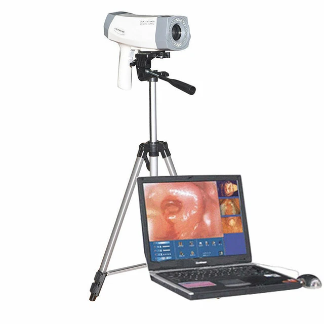 Carejoy Electronic Colposcope 800,000 High Resolution Color Camera+Tripod Set