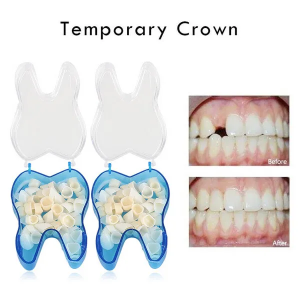 300 x Dental Resin Realistic Porcelain Temporary Teeth Crown Anterior Posterior