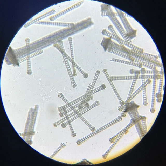 J.D. Moller Microscope Slide Sea Urchin Laganum Tonganense Q & G Tonga