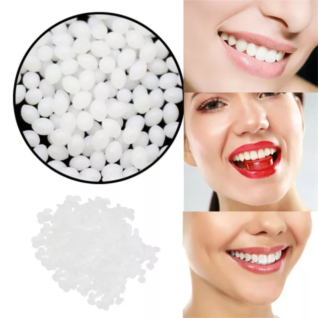 Temporary Tooth Repair Kit Teeth Veneers Moldable Fake Teeth