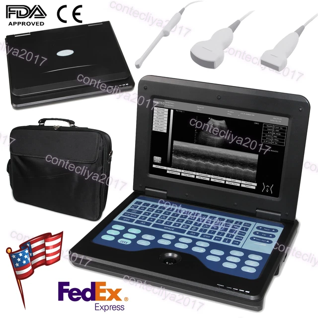 Human Portable Laptop Ultrasound Scanner Digital Machine Convex+Linear+Vaginal