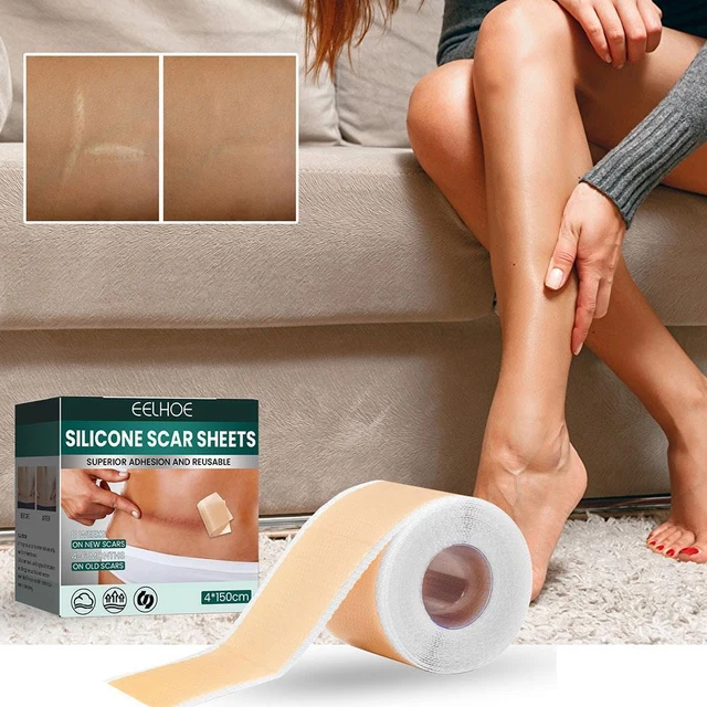 Fogli cicatrici ilicone, nastro cicatrice in silicone riutilizzabile e rimozione efficace foglio Z0J0