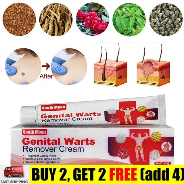 GENITAL HERPES WART Remover Ointment Skin Tag Mole Acuminatum Treatment