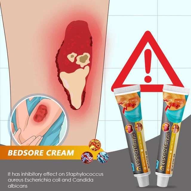 20G crema para heridas de cama dolor de cama ungüentos cama tratamiento de heridas rápido G6W8