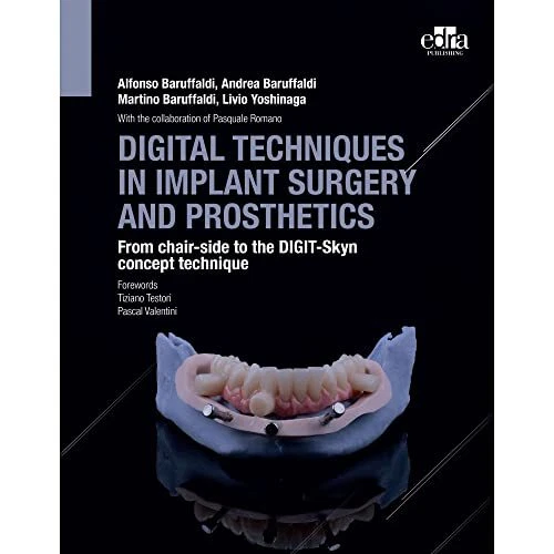 Martino Baruffaldi, DDS~Alfonso Baruffald Digital Techniques In Impl (Hardback)