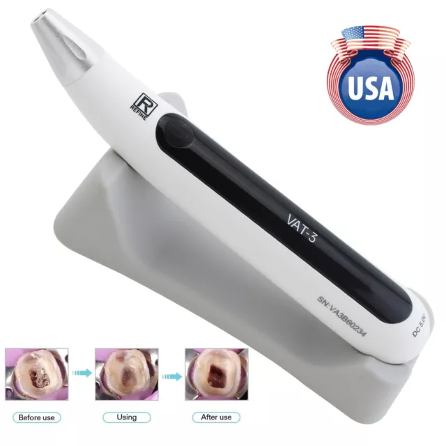 Refine Dental Ultrasonic Endo Activator Cordless Irrigator Root Canal Handpiece