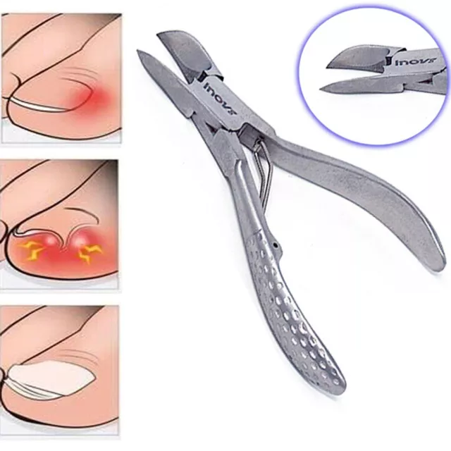 Chiropody TOE NAIL CLIPPERS For Thick Nails - Podiatry Heavy Duty NAIL CUTTERS