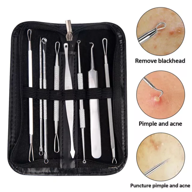 8x Blackhead Remover Pimple Popper Tool Kit Spot Acne Comedone Extrator Comedon