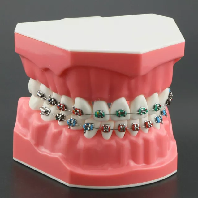 3Pcs Dental oral Orthodotic Teeth Model With Metal Bracket and Molar Teach Tubes