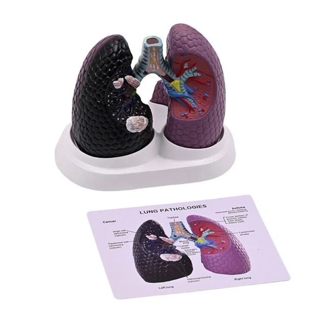 SCHOOL RESPIRATORY LUNG Model Structure Mold Pathological System £41.98 ...