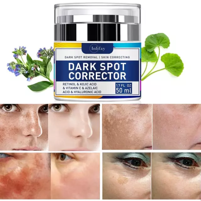 Crema removedora de manchas oscuras - 1,7 Fl Oz - tratamiento de hiperpigmentación para toda la piel T