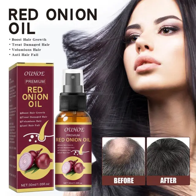 Onion Hair Oil | Hair Growth & Hair Fall Control Natural 10/30ML Care NEW U8E7