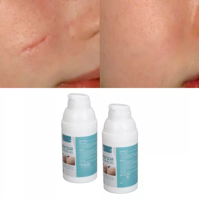 2 Pcs 30ML Scar Removal Gel Promote Healing Skin Moisturizing Smoothing GFL