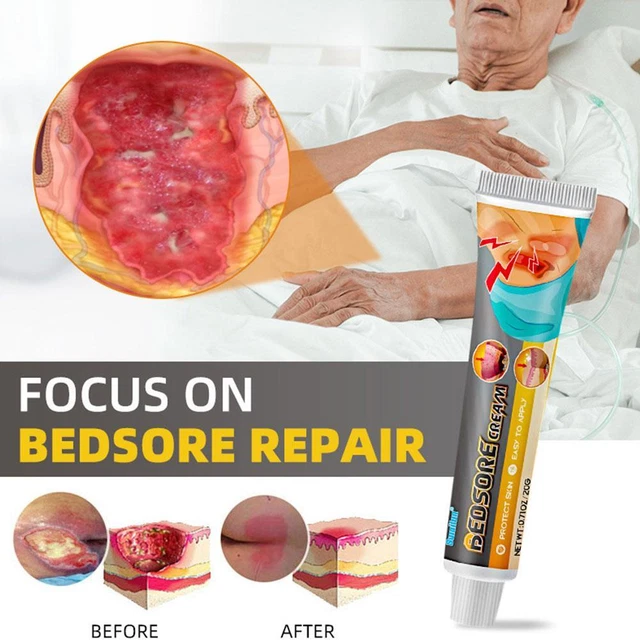 20 g Crema Dolor de cama Ungüento Ungüento Tratamiento Llagas de cama Gel de curación rápida de heridas