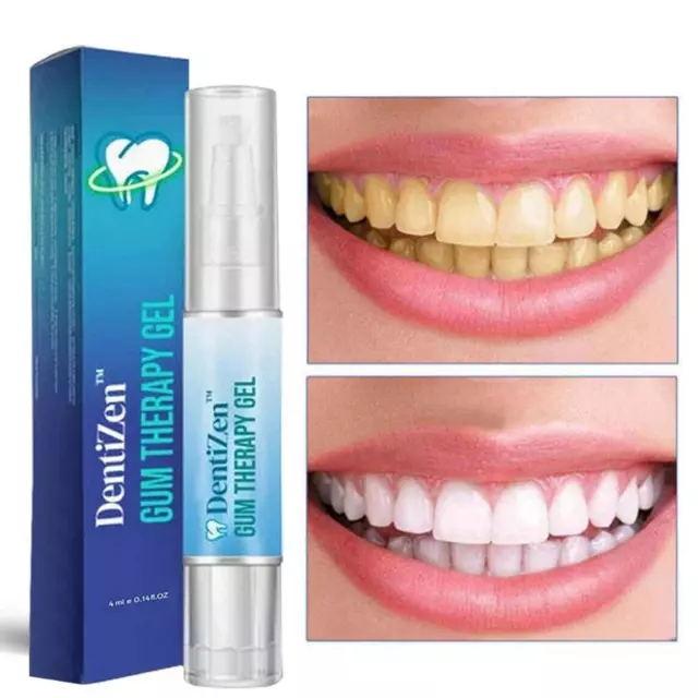 1*Teeth Whitening Essence Pen Tooth BrighteningRemover Stain