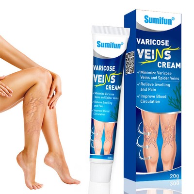 HEAVY LEGS SPIDER Veins Treatment Vasculitis Effective Varicose Veins