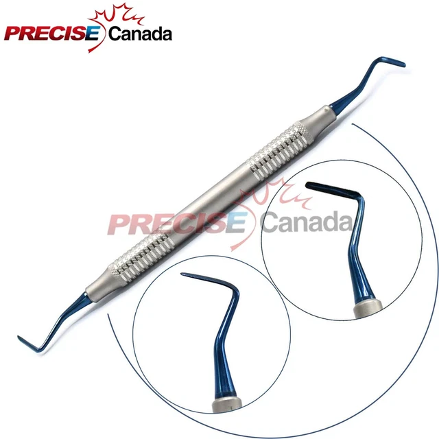 Legamento Parodontale - Le Cause Di Possibili Disturbi