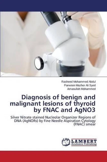 DIAGNOSIS OF BENIGN and malignant lesions of thyroid by FNAC and AgNO3 ...